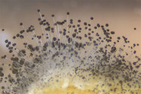 Mold Spores on Bread – Rhizopus under the microscope – Molekule Blog