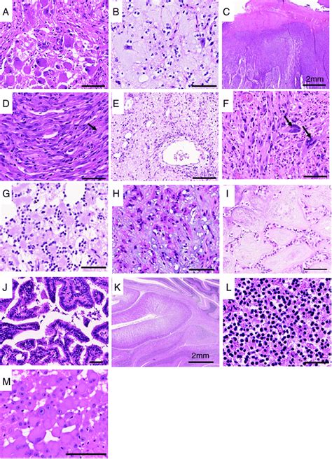 Histopathology of uncommon low-grade brain tumors (all hematoxylin and ...