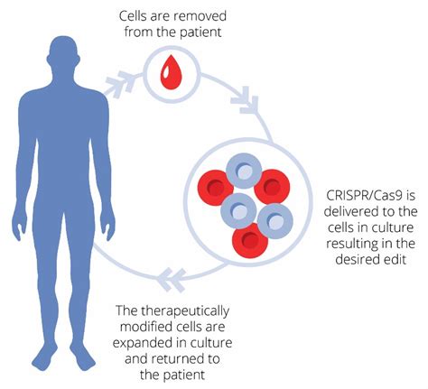 CRISPR Therapeutics Plans First CRISPR Clinical Trial in Europe for 2018