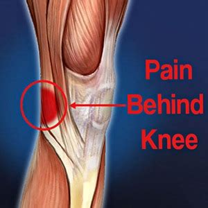 5 Pain Behind Knee Causes with Relief Tips