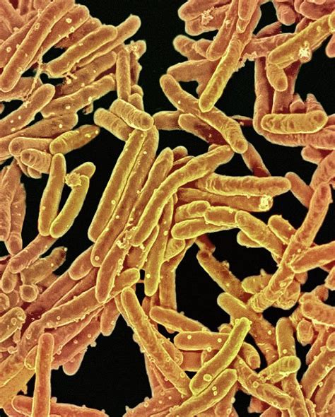 Tuberculosis Bacteria Photograph by Ami Images/niaid - Pixels