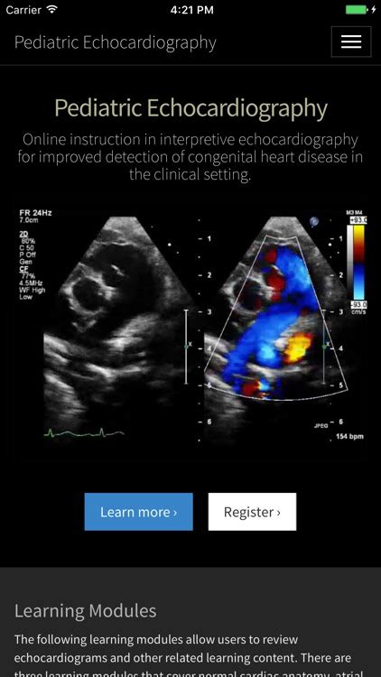 Pediatric Echocardiography by Josh Kailin