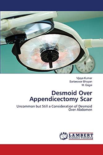 Desmoid Over Appendicectomy Scar: Uncommon but Still a Consideration of ...