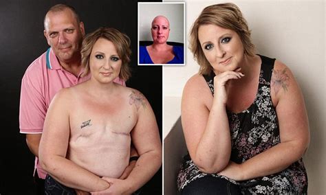 Breast cancer survivor poses topless after double mastectomy | Daily ...