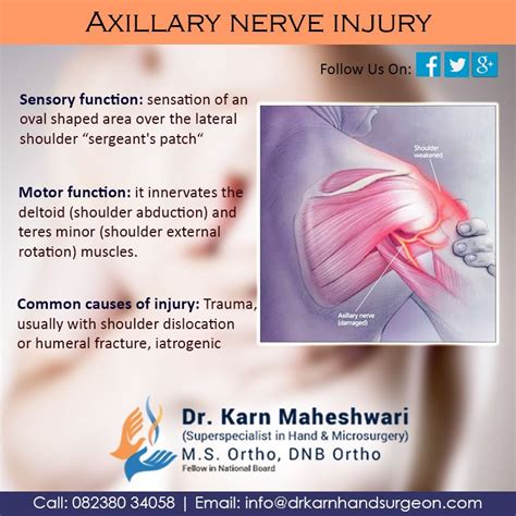 Axillary nerve injury | Axillary nerve, Shoulder dislocation, Nerve