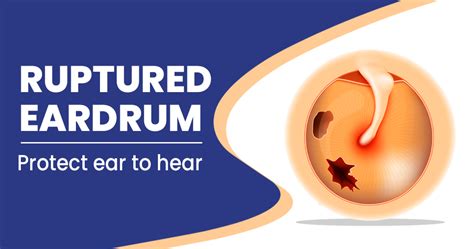 Ruptured Ear Drum Symptoms