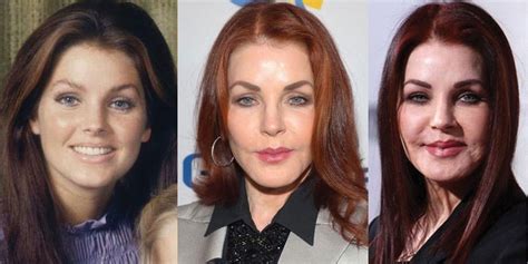 Priscilla Presley Plastic Surgery Before and After Pictures 2024