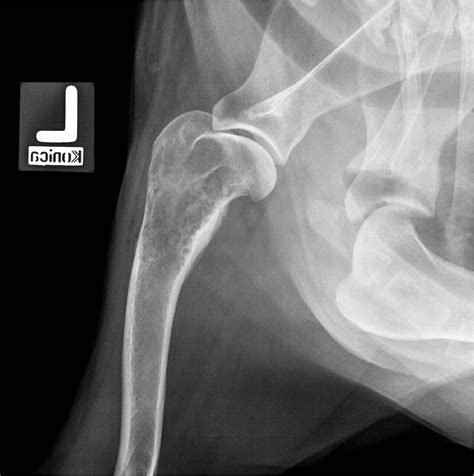 Figure 6 from Imaging of primary bone tumors in veterinary medicine: which differences ...