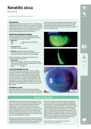 Scleral lens case report series beyond the corneal borders | PDF