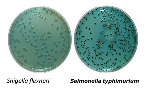 Hektoen Enteric | Microbiology, Medical laboratory science, Medical ...