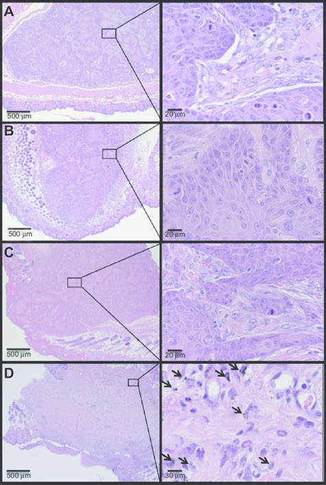 histology of representative tumors excised after 10 days of treatment.... | Download Scientific ...