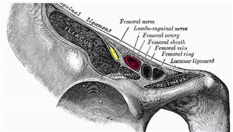 Fascia Iliaca Compartment Block — Downeast Emergency Medicine