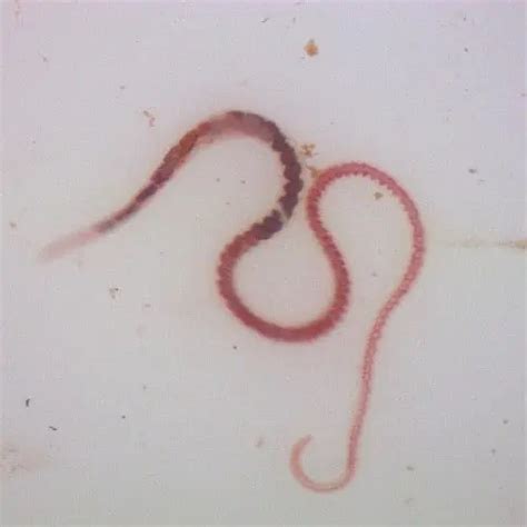 Aquatic Worms Facts (Limnodrilus hoffmeisteri) - Pond Informer