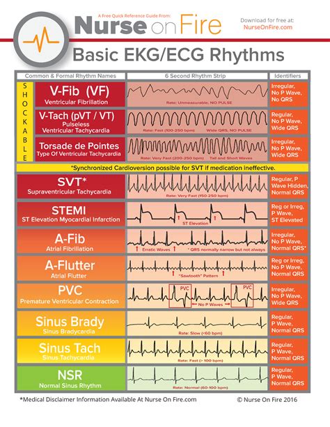 Basic EKG Rhythms - EKG - Basic EKG/ECG Rhythms V-Fib (VF) V-Tach (pVT / VT) Torsade de Pointes ...