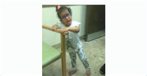 The girl with spastic quadriplegia and refractive error. After... | Download Scientific Diagram