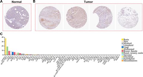 The Human Protein Atlas database analysis. A, B The Human Protein Atlas ...