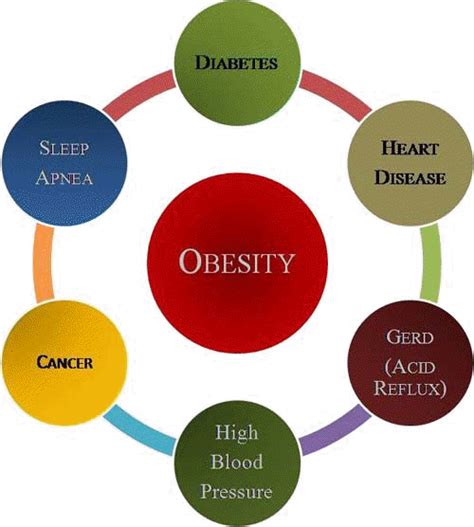 Survey Of The Obesity Drug Market | Seeking Alpha