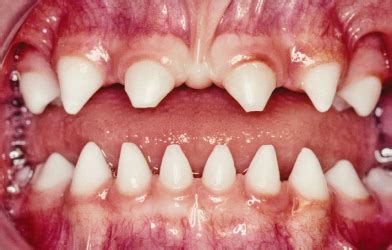 42 Disorders of tooth shape and size | Pocket Dentistry