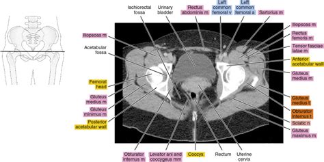 Female Pelvic Ct Scan Labeled - vrogue.co
