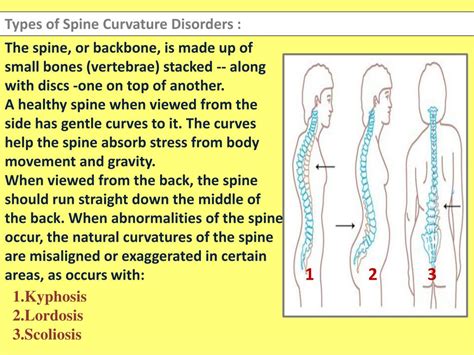 PPT - Spine Curvature Disorders PowerPoint Presentation, free download ...