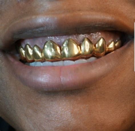 Sterling Silver W/ 18k Yellow Gold Plated Perm Cut Custom Fit Real Grill Grillz