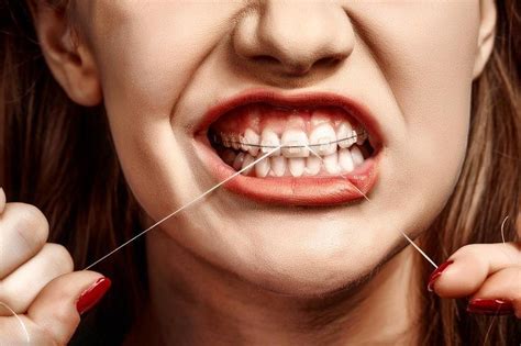 Today is National Flossing Day. And even though flossing may be harder with braces it's still ...