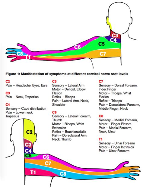 Cervical Radiculopathy - Emergency Physicians Monthly Muscle Anatomy ...