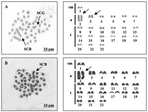 Conventional staining of the metaphase chromosome plates and karyotypes... | Download Scientific ...