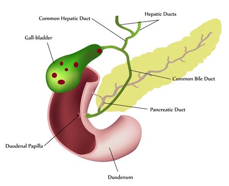 Gall Bladder Stone