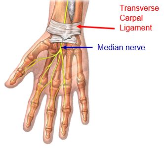 Wrist Pain - Fitter Golfers