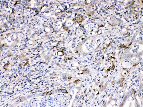 Bax Antibody (PA5-78857)