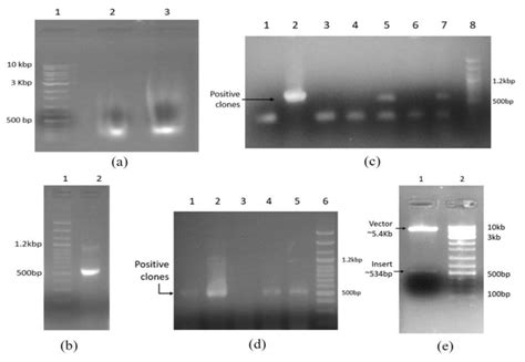 Agarose gel electrophoresis results (a) isolated mRNA, Lane 2 and 3... | Download Scientific Diagram