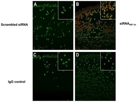 Anti-CD3 antibody (ab5690) | Abcam