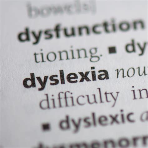 Unlocking the Power of Dyslexia: Embracing Neurodiversity - Eternal Engagements