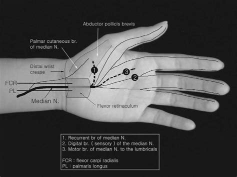 Upper Extremity Nerve Conduction Studies