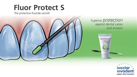 Fluor Protector S - The protective fluoride varnish provides superior ...