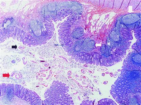 Appendix Histology