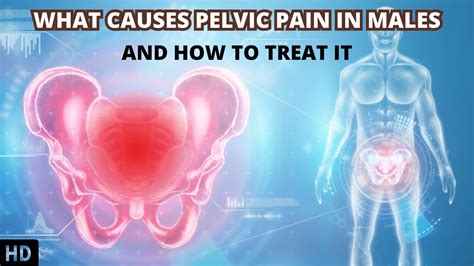 Decoding Pelvic Pain in Males: Understanding the Root Causes - YouTube