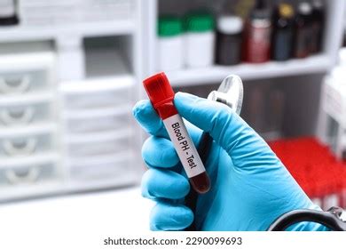 Blood Ph Test Look Abnormalities Blood Stock Photo 2290099693 | Shutterstock