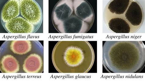 Aspergillus Niger Under Microscope