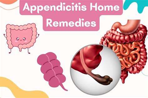 Appendicitis Home Remedies 2023, Diagnosis & Treatment