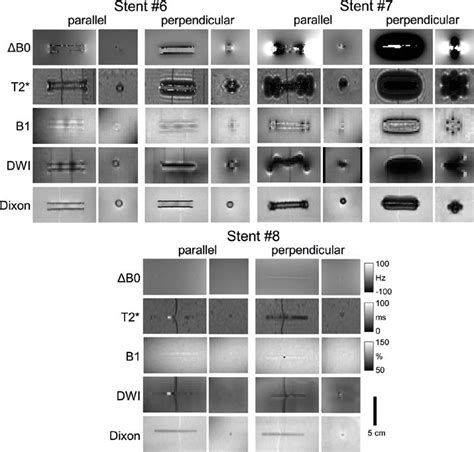 2. ΔB0-maps (top row), T2*-maps (second row), B1-maps (third row), DWI ...