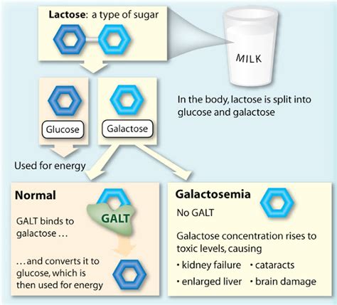 MEDICAL PG QUESTION BANK: Most common enzyme deficiency responsible for galactosemia is: