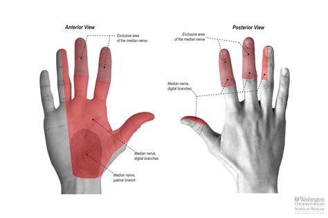 Common Palmar Digital Nerve | Median nerve, Nerve inflammation, Carpal tunnel syndrome