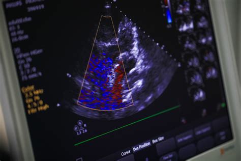 Private Echocardiogram Heart Scan Across the UK | Vista Health