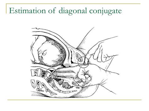 PPT - Female pelvis . Fetus as the object of labor . Obstetric terminology METHODS OF ...