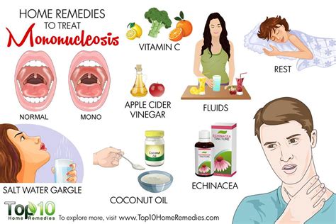 Symptoms Of Mononucleosis Include