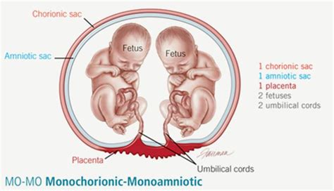 Doctors Warn Canadian Mother About Pregnancy After Receiving Her Ultrasound Results | LifeDaily