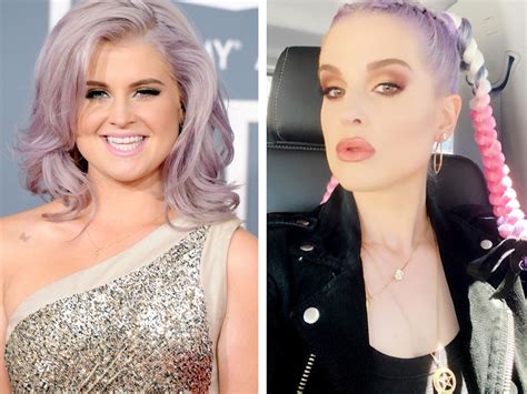 Kelly Osbourne Before And After Plastic Surgery