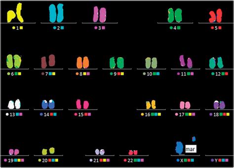 Multicolor FISH (M-FISH) analysis showing a marker chromosome is ...